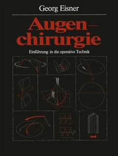 buecher Augenchirurgie (eBook PDF) von Georg Eisner - bücher.de Discount Store für neue Produkte